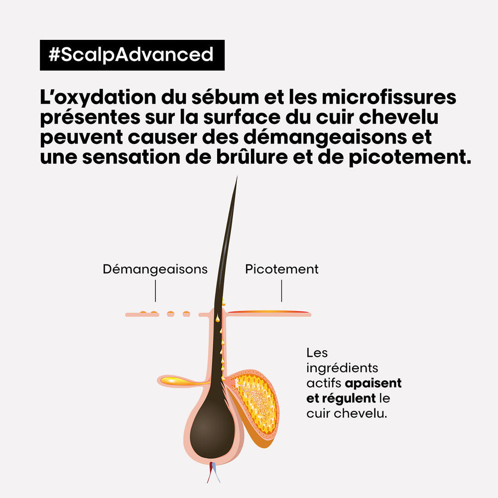 Scalp Advanced | Shampooing Anti-gras
